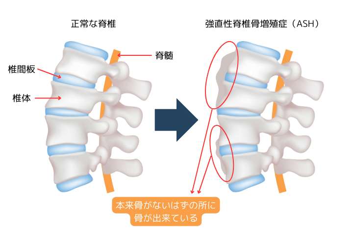 8. いびきをチェックしてもらう