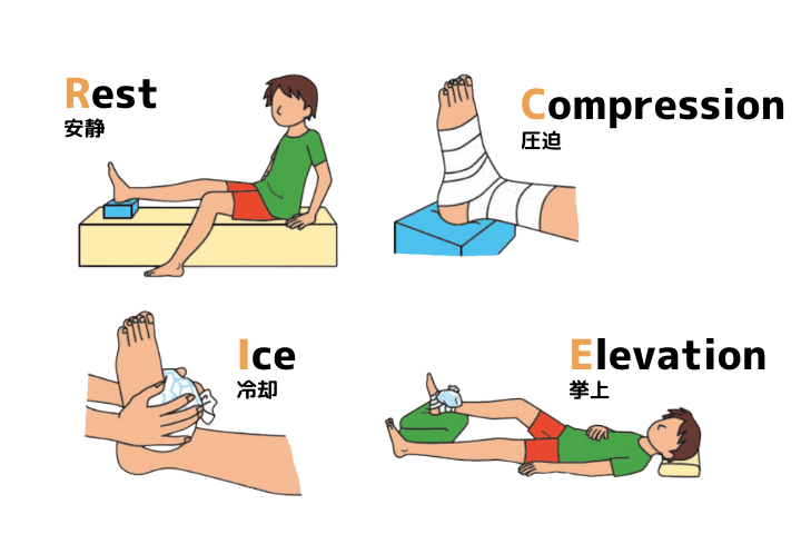 スポーツ外傷・障害のアウフバウトレーニング スポーツ外傷・障害